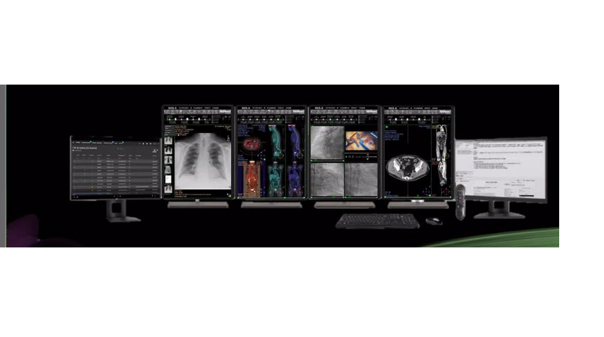 screenshot of Acuo VNA